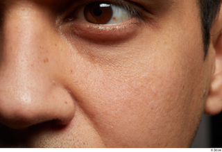  HD Face skin references Rafael chicote cheek eyes nose skin pores skin texture wrinkles 0002.jpg